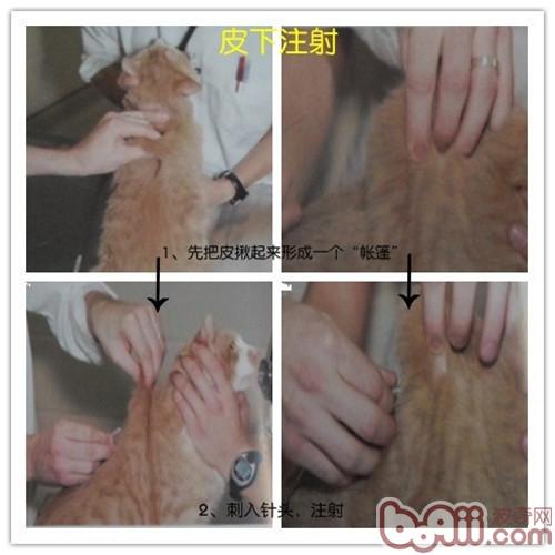 皮下注射
