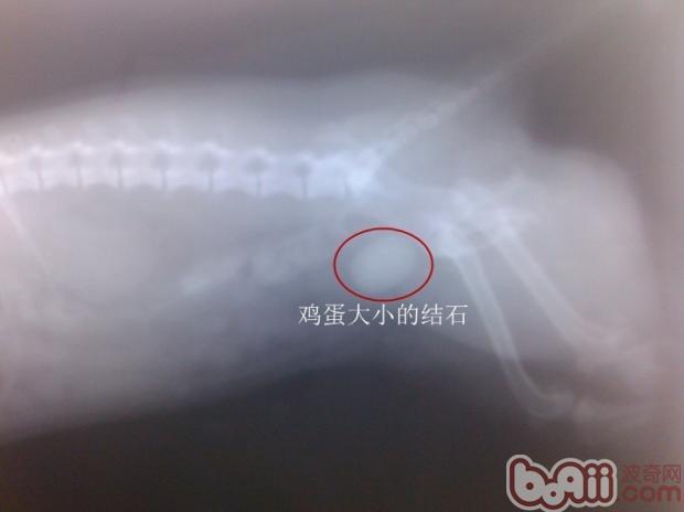 x光片拍出的雞蛋大小的結石
