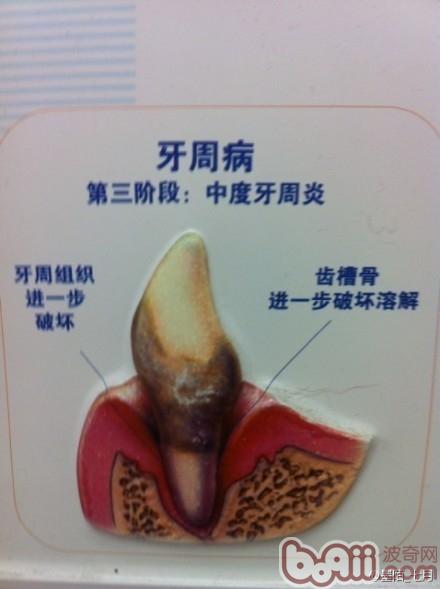 牙菌斑帶來的危害