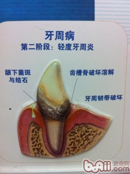牙菌斑帶來的危害