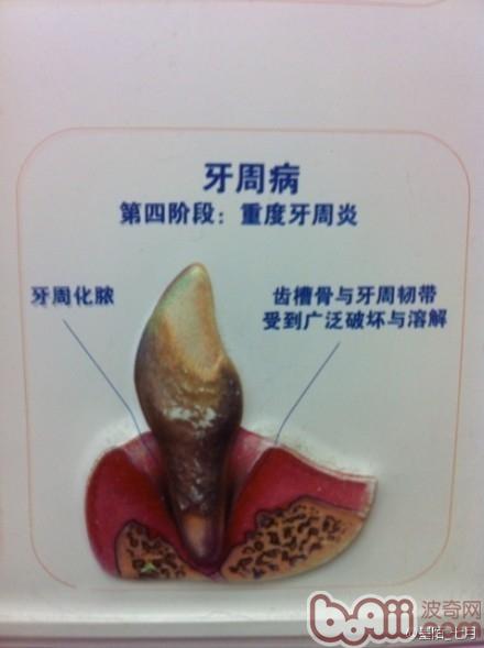 牙菌斑帶來的危害