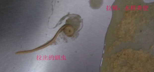 拉出的蛔蟲