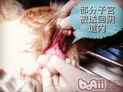 部分子宮被送回陰道內