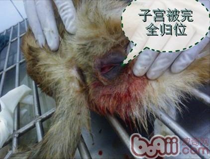 子宮被完全歸為