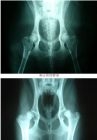 犬髋關節發育不良2.jpg