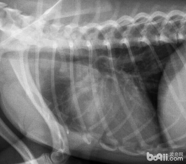 X-光影像顯示肺部感染