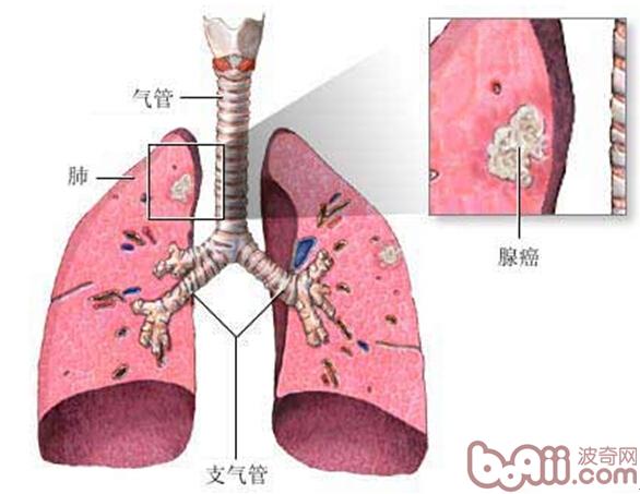 鹦鹉熱衣原體肺炎
