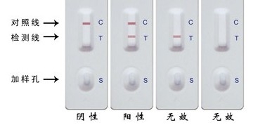 臨床診斷