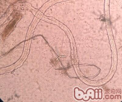圖5 鏡檢見真菌菌絲