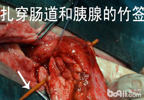 致命的竹簽