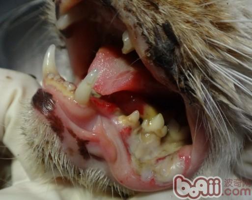 圖3 下唇角大面積潰瘍、壞死